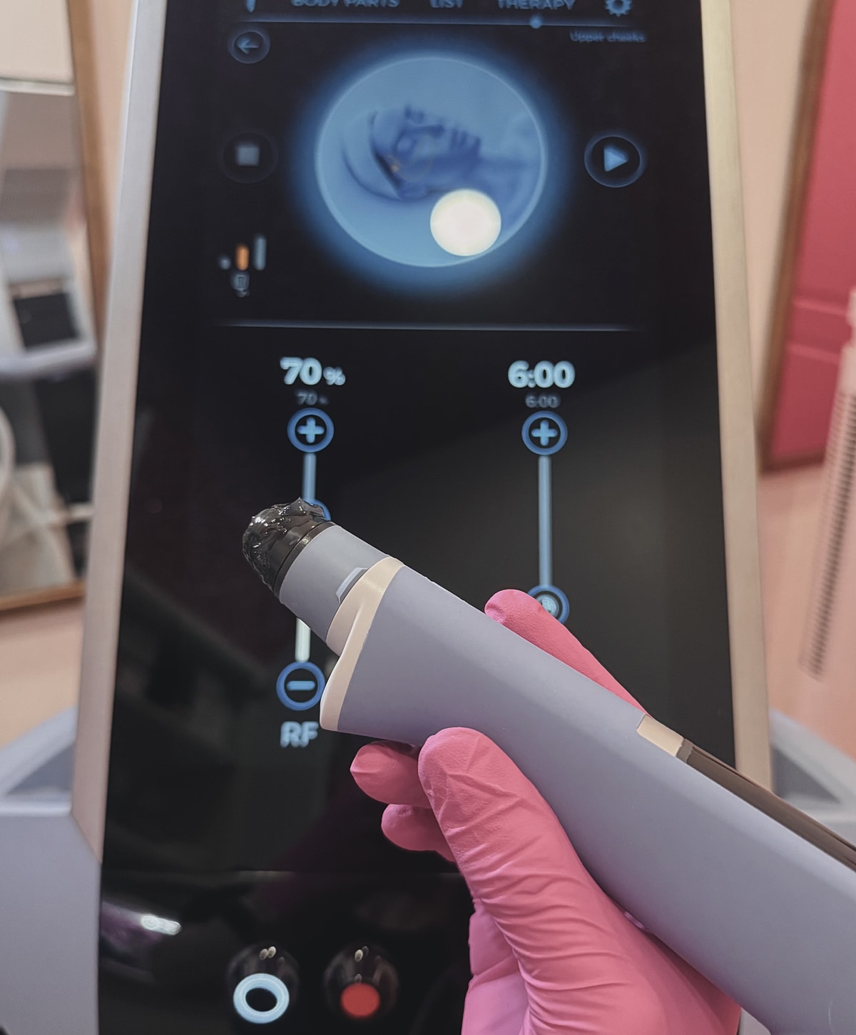 Exion device with touchscreen display.