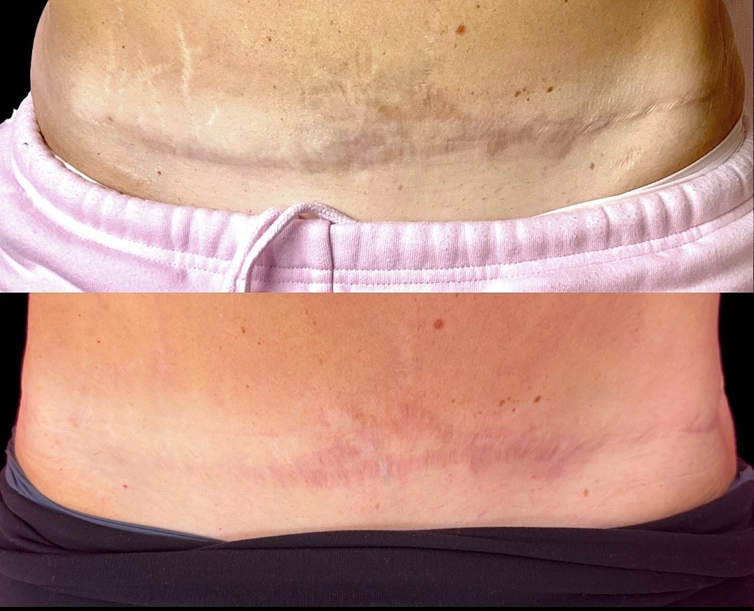 Neon sign for Alpenglow Aesthetics Medical Spa