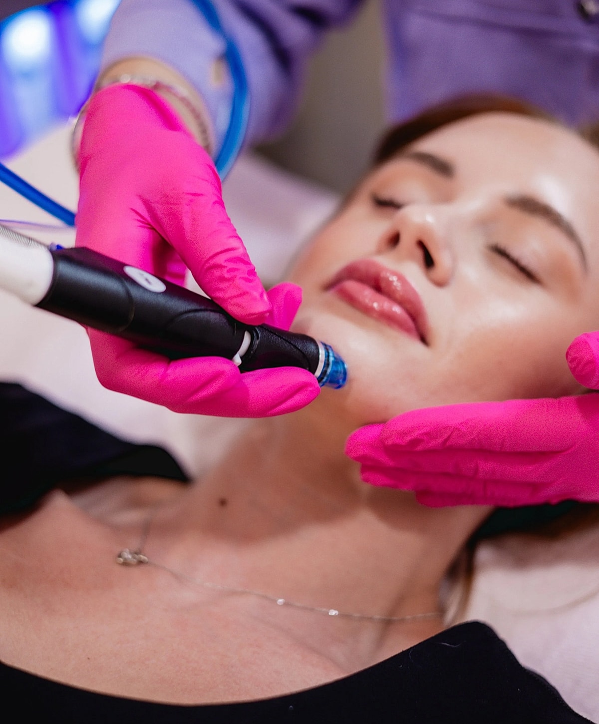 Whitefish Hydrafacial model receiving treatment