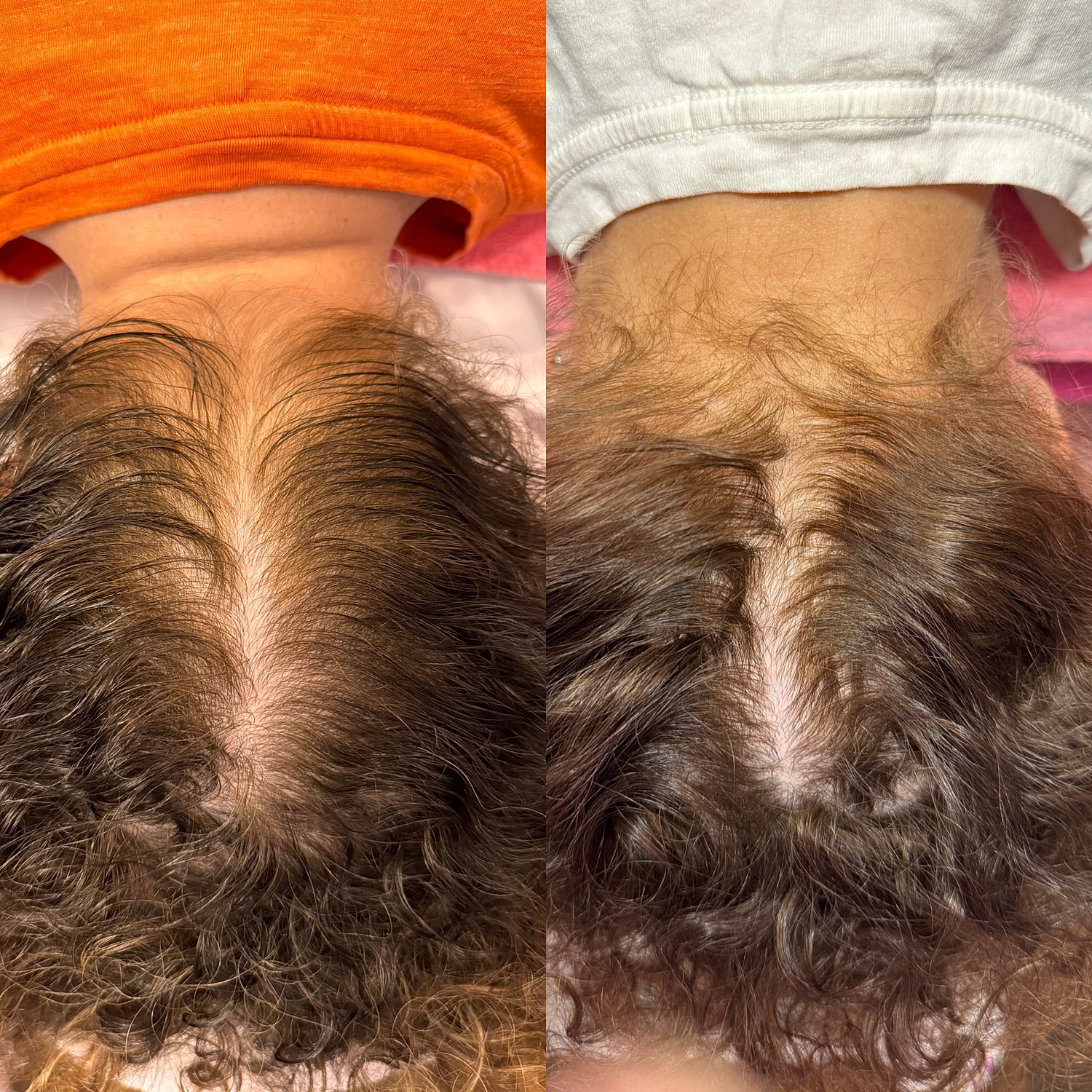 Hair care products and tools arranged neatly.