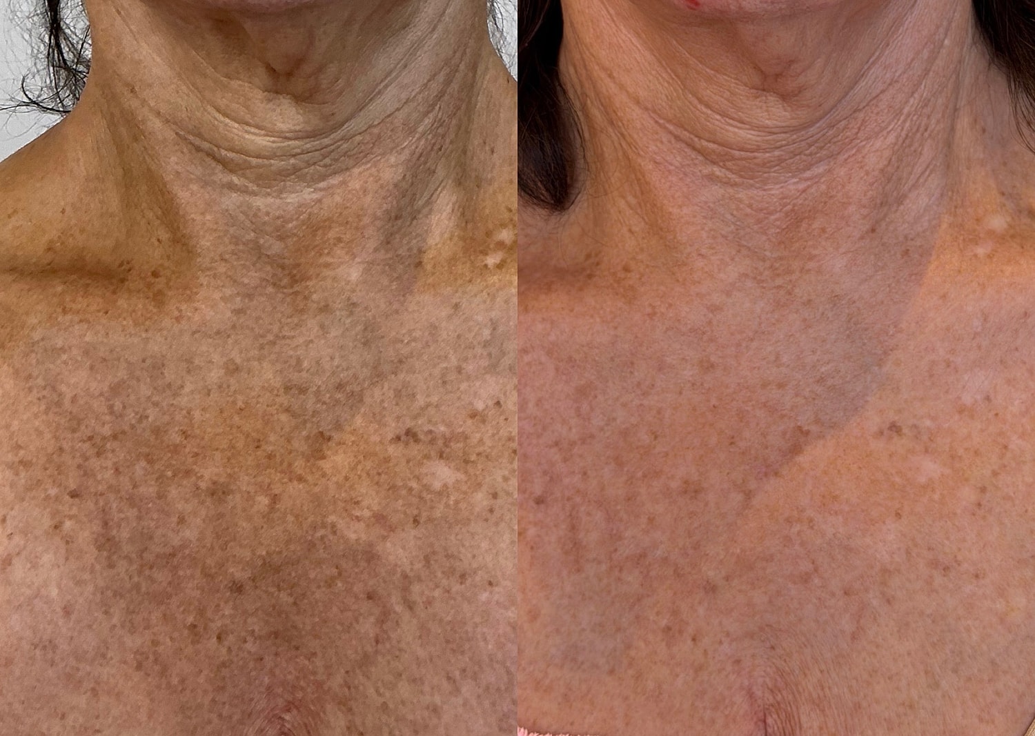 Before and after skin treatment comparison.