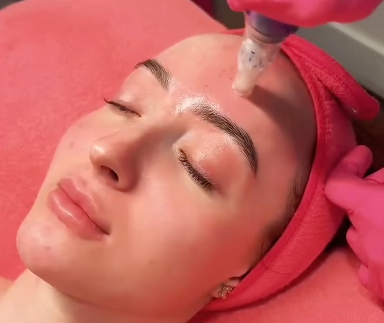 Facial treatment with serum application in progress.