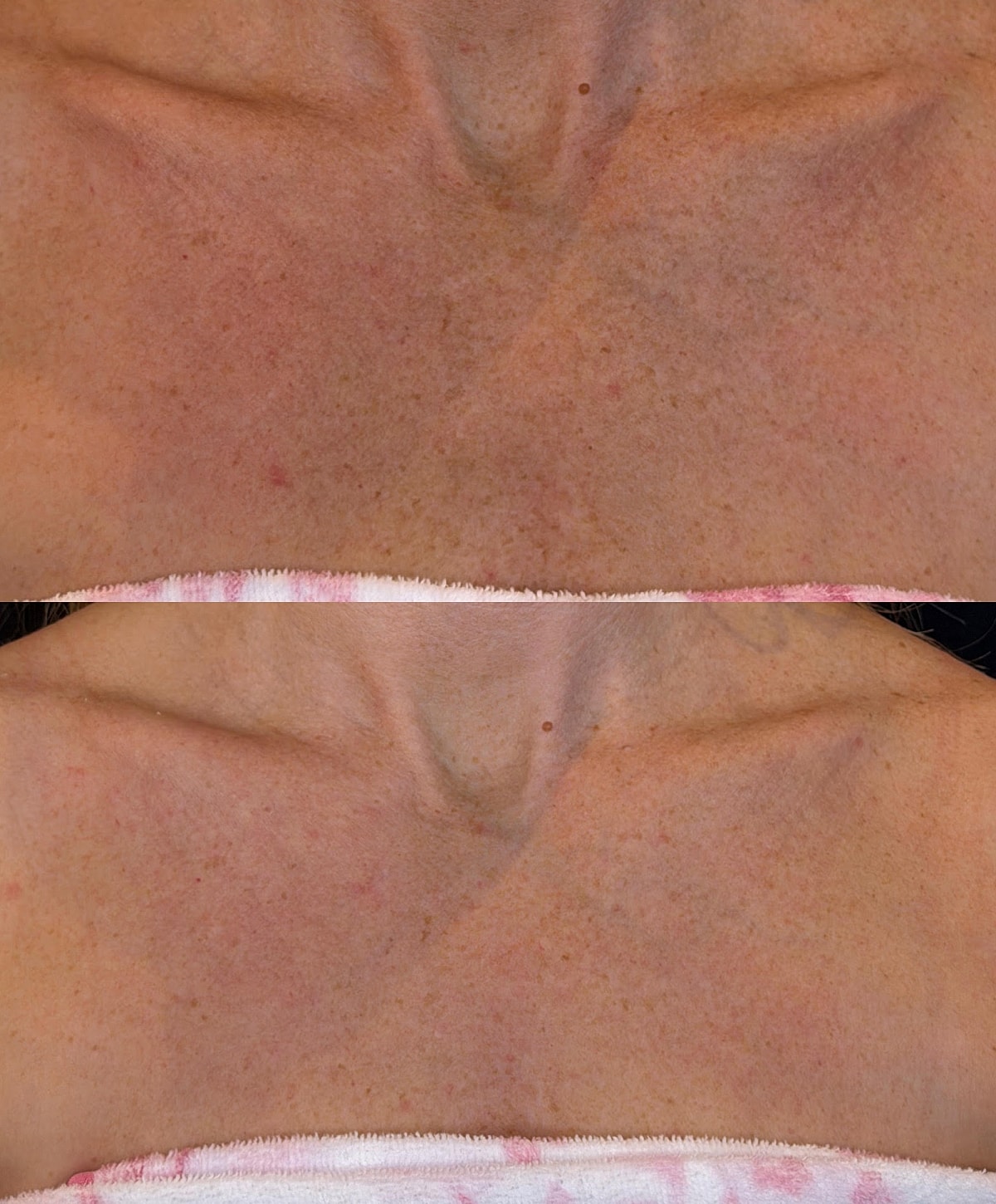 Advanced skincare treatment device with touchscreen interface.